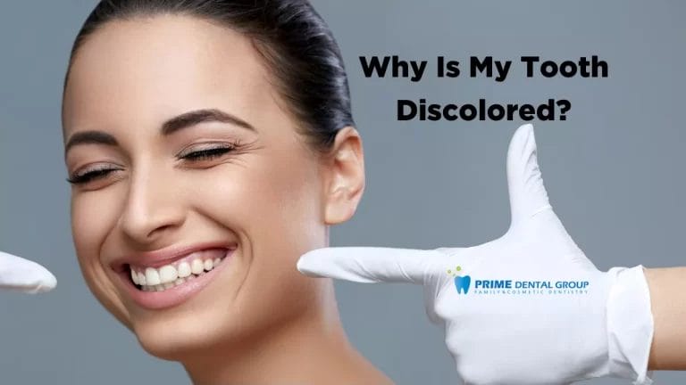 Why Is My Tooth Discolored? 10 Causes of Tooth Discoloration