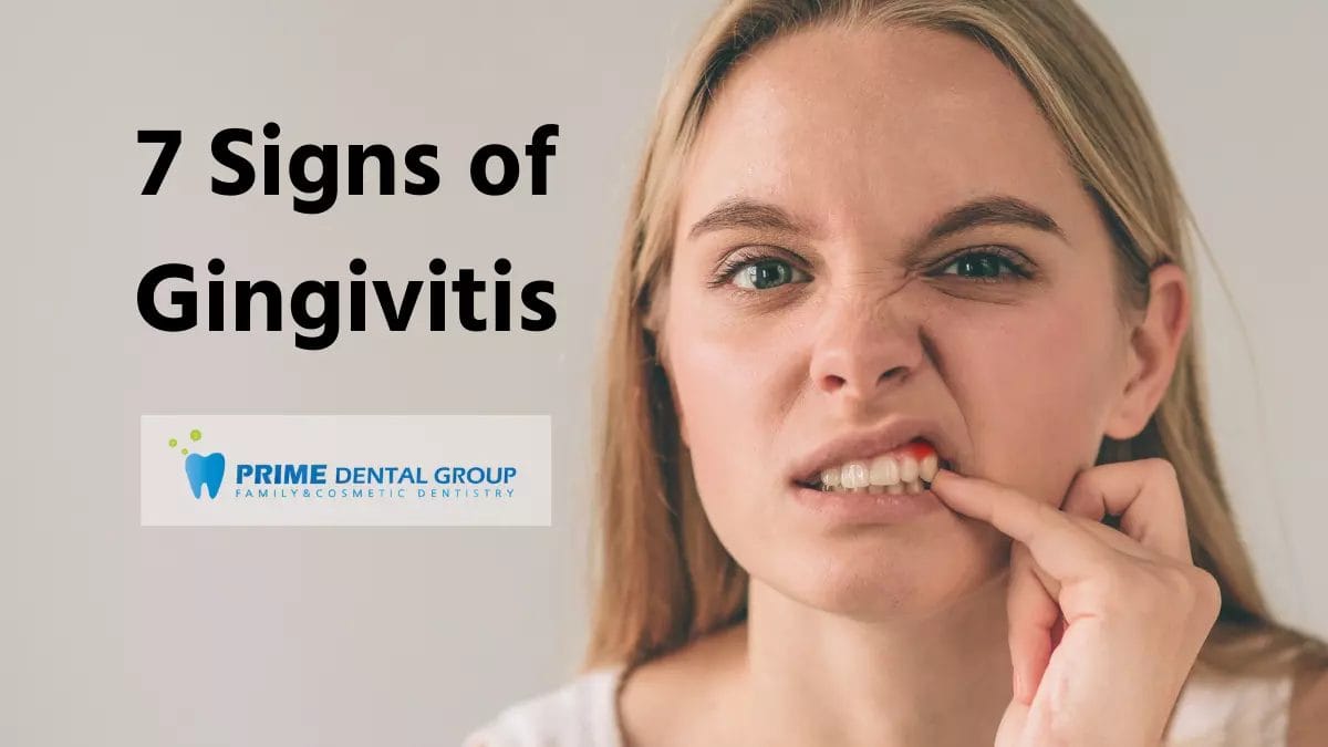 7 Signs of Gingivitis