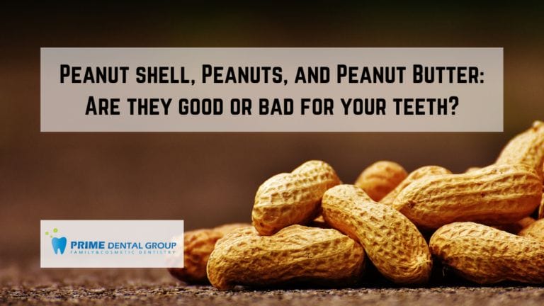 Peanut shell, Peanuts, and Peanut Butter – Are they good or bad for your teeth?
